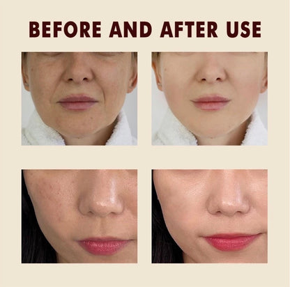 Instant Exfoliating Pore Shrink Serum | Dr. Melaxin Korean Skincare
