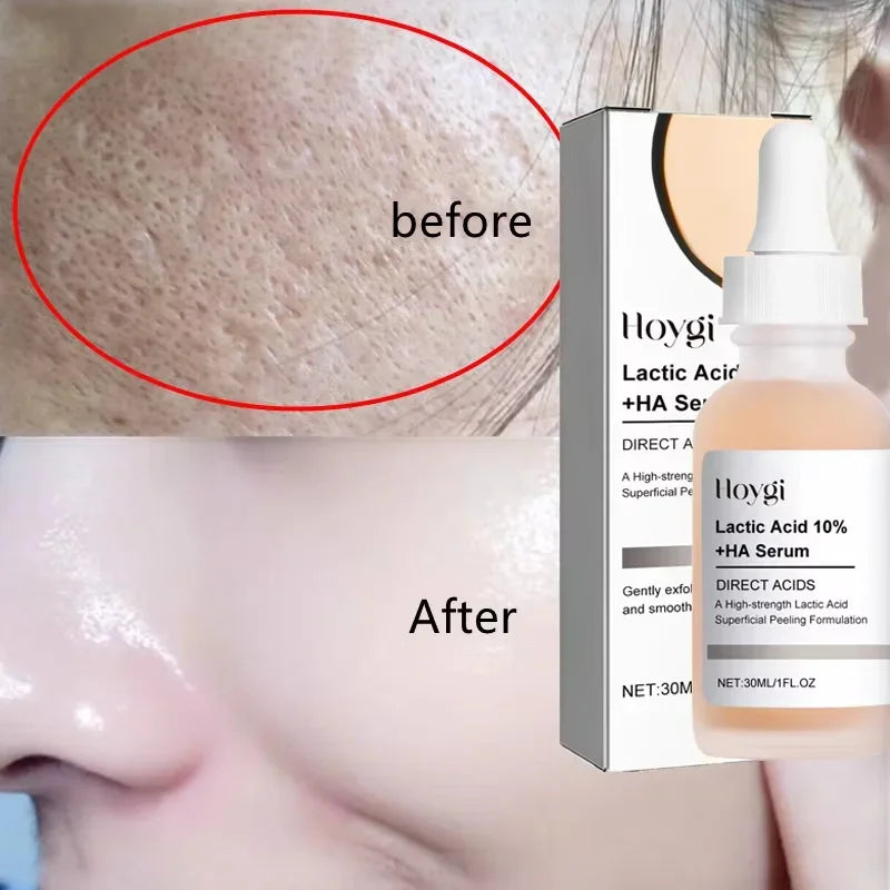 Instant Pore Shrinking Serum | Smooth Korean Skincare